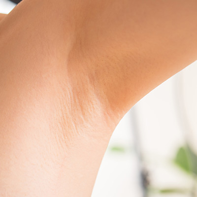 Underarms